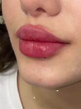 Butterfly Lips